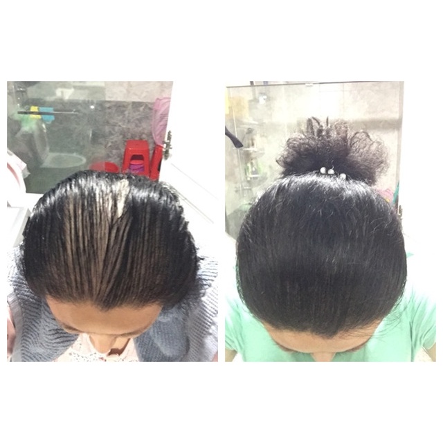 Folihair Shampoo dan Tonic Obat Penumbuh Rambut Botak Serum Rambut Shampo Penumbuh Rambut