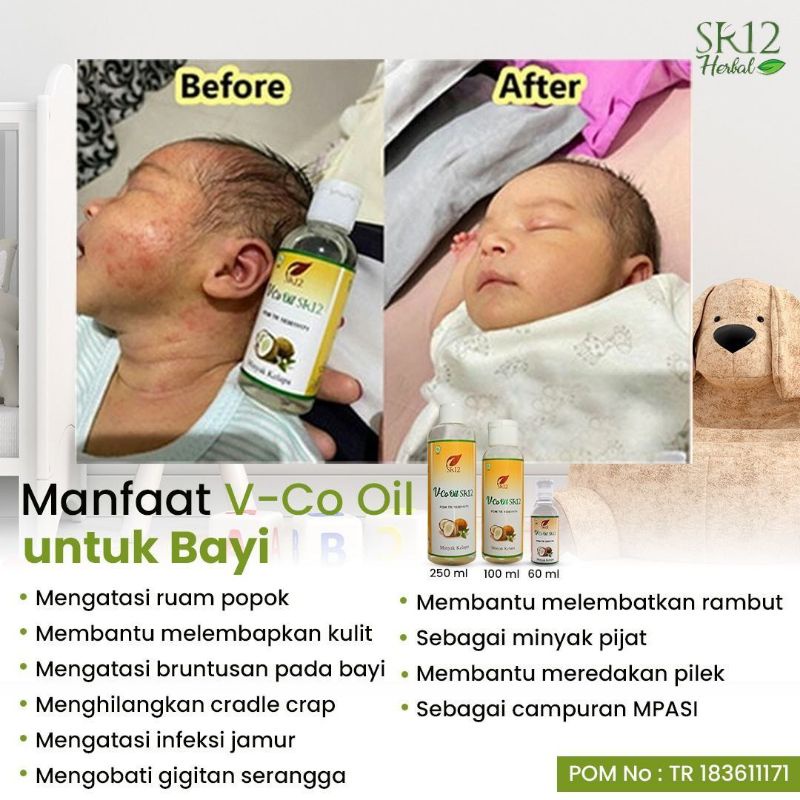 VCO SR12 VICO OIL VIRGIN COCONUT OIL 60ml VCO Minyak Kelapa Premium Murni BPOM Imun Booster Alami