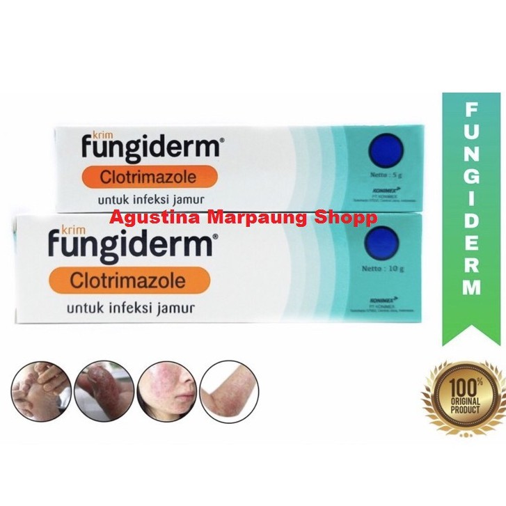 Fungiderm cream 5 gram &amp; 10 gram ( krim gatal panu kadas jamur )