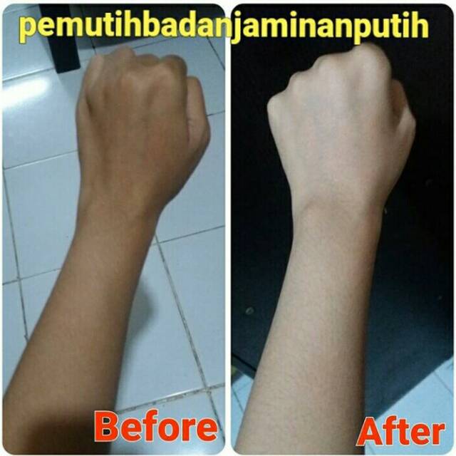 LOTION PEMUTIH KROMOSOM / LOTION DOKTER YANG AMPUH MEMUTIHKAN KULIT SUSAH PUTIH