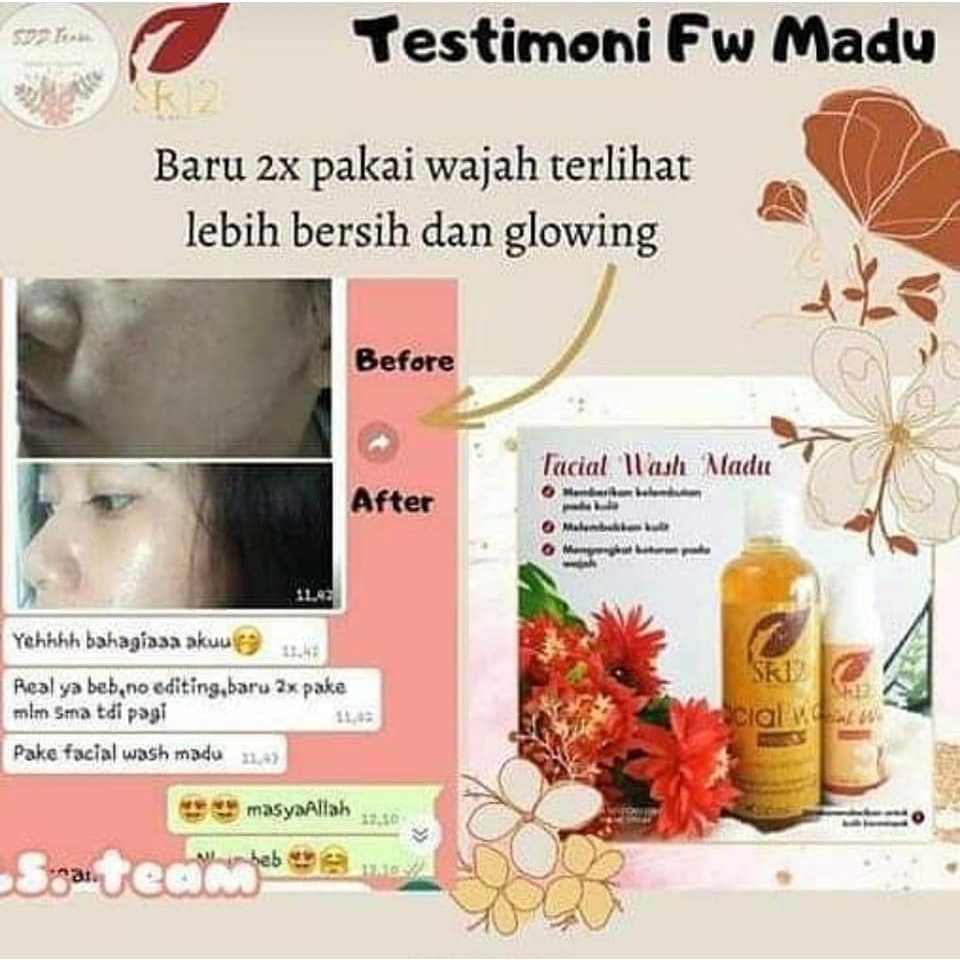 Facial Wash SR12 | Facial Wash Bulus &amp; Facial Wash Honey | Sabun Wajah SR12 Skincare