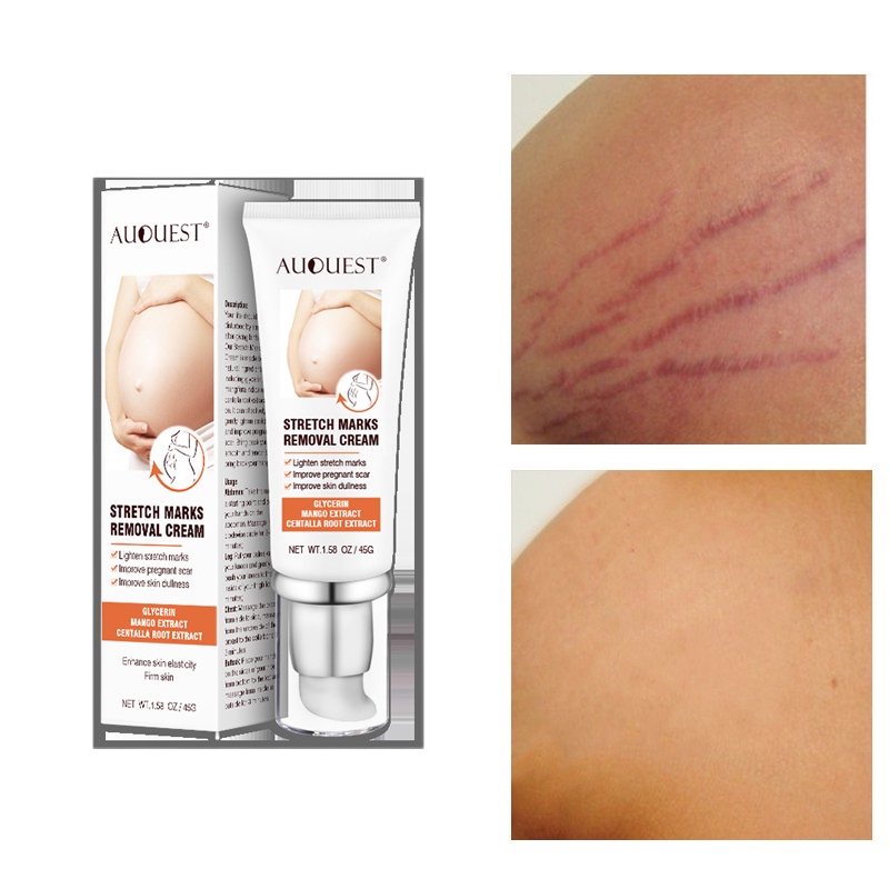【Barang spot】Krim Strechmark Ampuh Salep Strechmark Cream Penghilang Luka Penghilang Strechmark Obat Penghilang Strecmark Paling  Mamas Choice Stretch Mark Cream Ibu Hamil Bio Oil Stretch Mark Safe Natural Maternity Skincare For Pregnant Moms Lotion