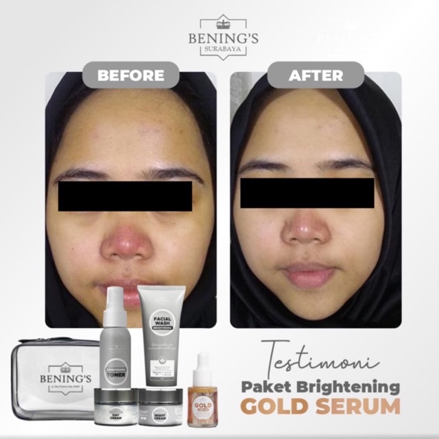 BENING'S PAKET BRIGHTENING | MENCERAHKAN &amp; MENGATASI KULIT KUSAM