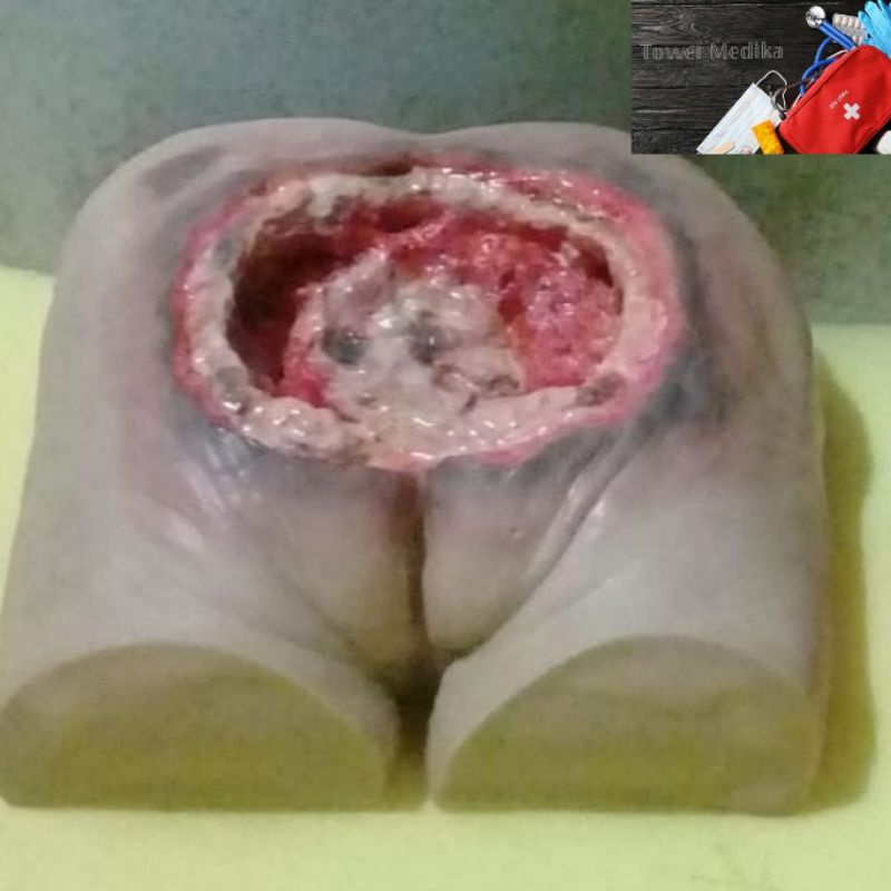 PHANTOM MANIKIN BOKONG BOROK/PANTAT DECUBITUS
