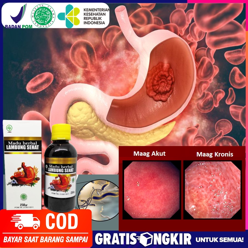 Obat Maag Asam Lambung dan Gerd / Obat Herbal Maag / Obat Asam Lambung / Kunyit Temulawak Madu Kurma