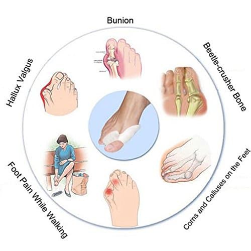 Bunion Corrector and Bunion Splint for Bunion Relief Bunion Toe