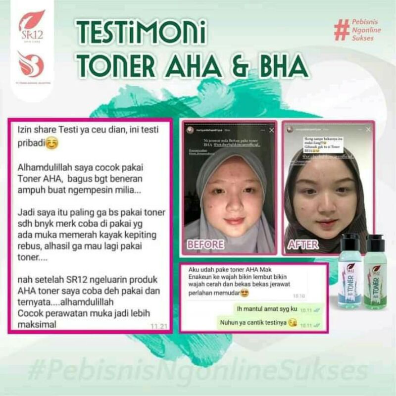 VIRAL  TONER FLEK HITAM AMPUH/TONER BHA SR12/MENGURANGI FLEK HITAM