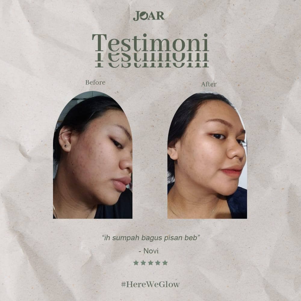 (DIJAMIN ORI 100%) - JOAR SKINCARE Paket Brightening Serum dan Facial Soap / Paket Pencerah Wajah / Sabun Muka Pria Jerawat / Sabun Wajah Glowing / Serum Essence BPOM HALAL [Bisa COD]