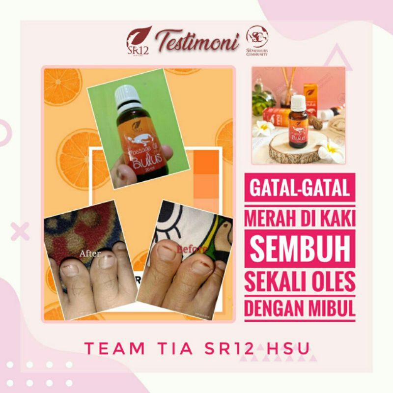 MINYAK BULUS SR12 OBAT GATAL KULIT DAN PEMUDAR BEKAS LUKA