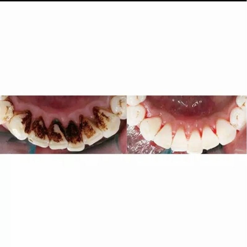 YABANJING WHITENING TEETH / YABANJING PEMUTIH GIGI 10ML