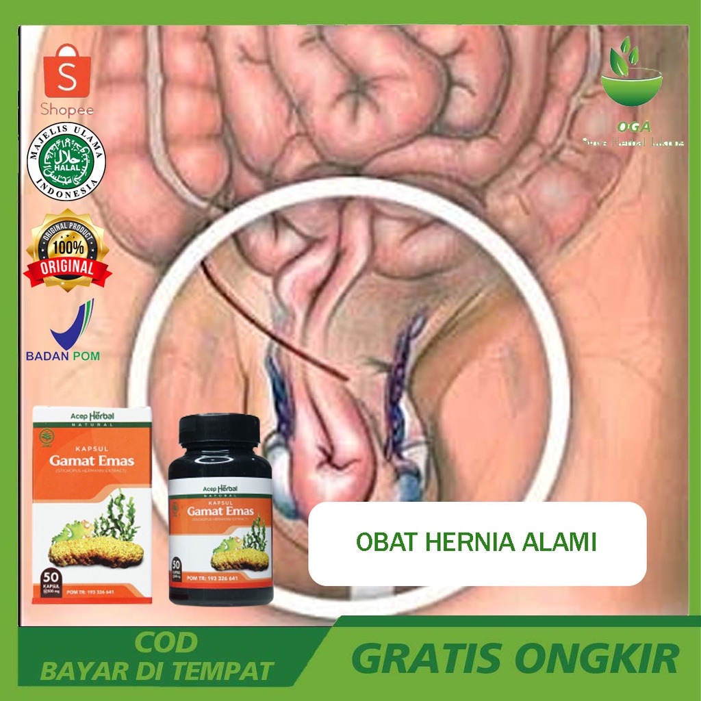 GOLDMAX Obat Hernia Alami Harga Obat Hernia Di Apotik Obat Hernia Herbal Obat Untuk Hernia Tulang Be