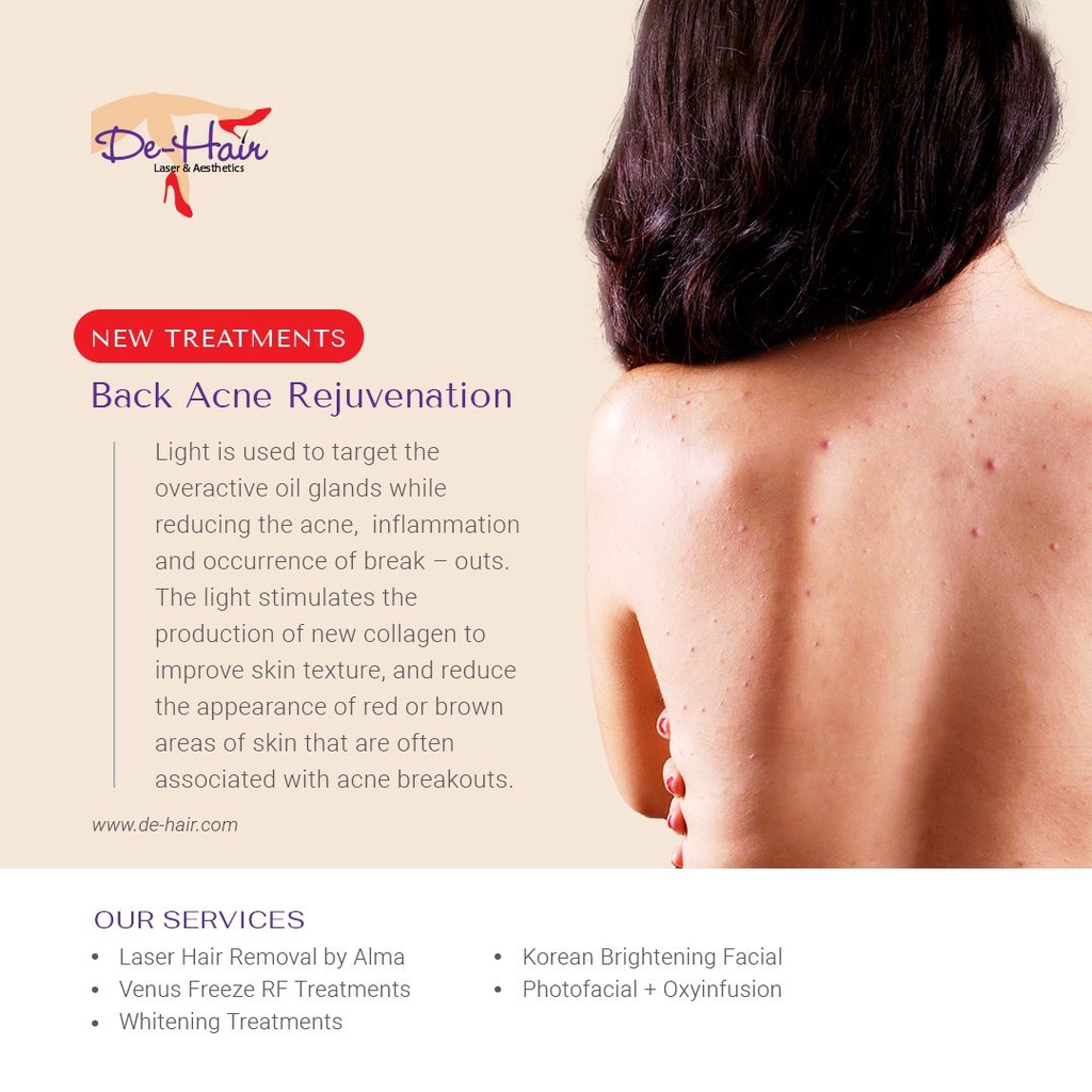 Full Back Acne Rejuvenation
