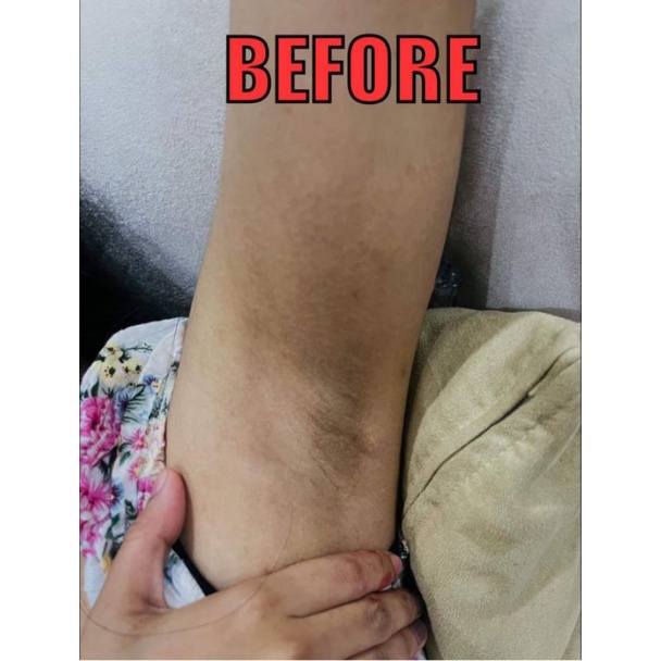 Erfast Neck cream & Dark Skin Area