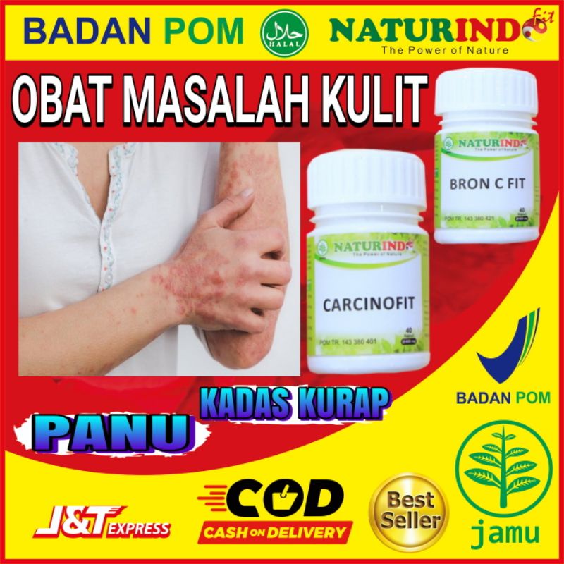 Obat Panu Kadas Kurap Kudis Herbal Ampuh Obat Gudik Gudikan Gatal Gatal Kulit Sensitif