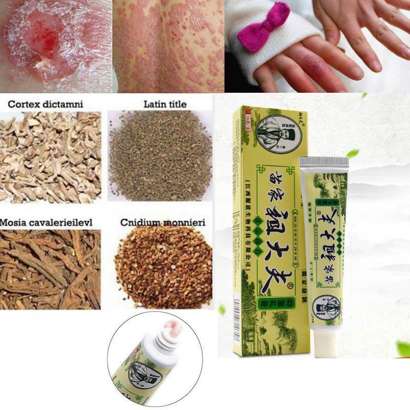 salep dermatitis SALEP ZUDAIFU 100% original psoriasiseksim