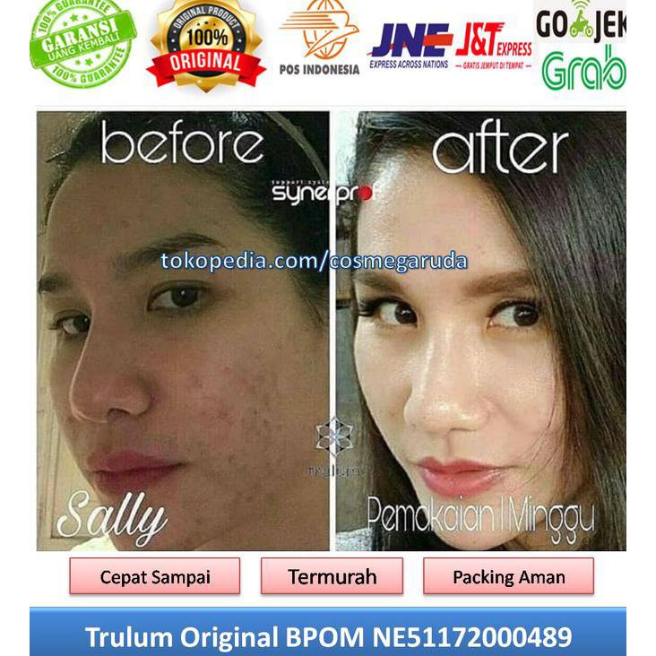 BWXQ PEMUTIH WAJAH PRIA/WANITA ! TRULUM SKINCARE BY SYNERGY WORLDWIDE UTAH SYTH