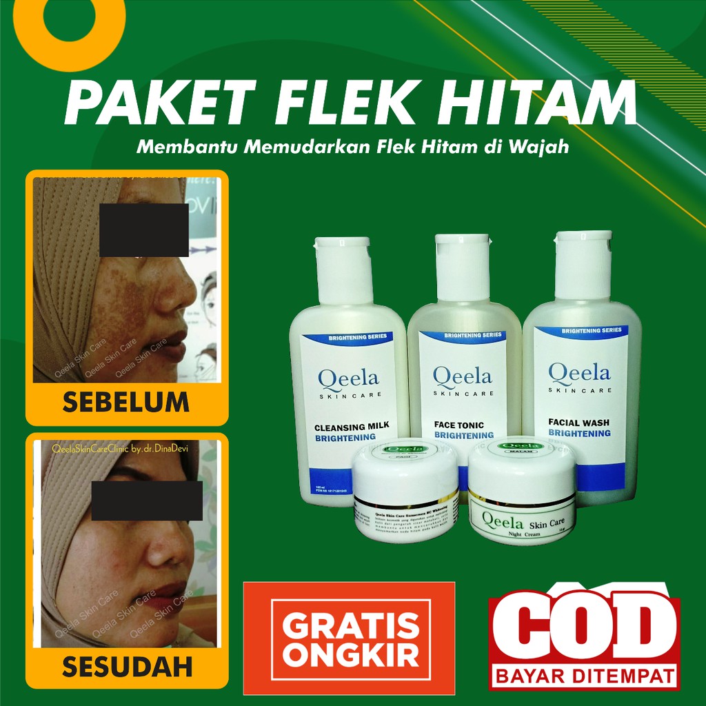 Qeela Skincare -  Krim Flek Hitam / Krim Flek Hitam Membandel / Krim Flek Hitam Parah / Cream Flek