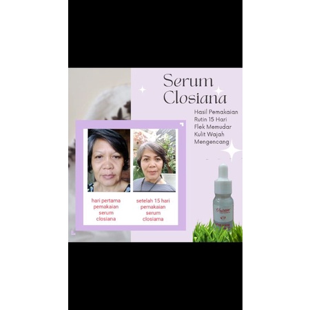 serum closiana isi 6 botol 10ML fre member ISI 6 BOTOL/10ML dijamin original 100% agen resmi