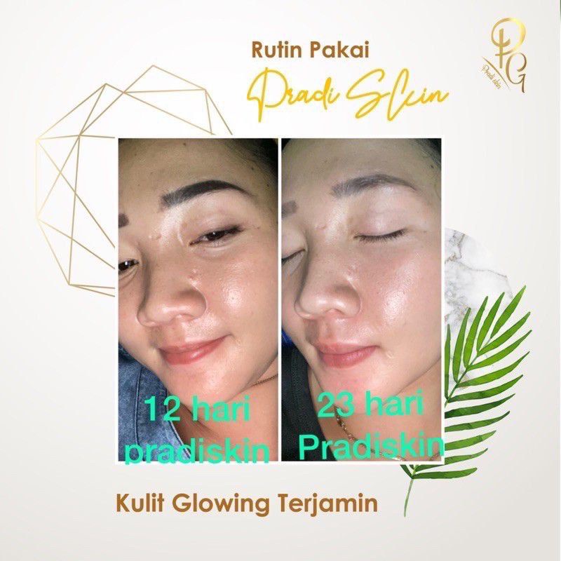 PRADISKIN GLOWBEAUTY ORIGINAL / PRADISKIN GLOW / PRADISKIN SKINCARE / PRADISKIN NIGHT CREAM / PRADISKIN GLOWBEAUTY SKINCARE BPOM PENGHILANG JERAWAT PENCERAH WAJAH / PRADISKIN