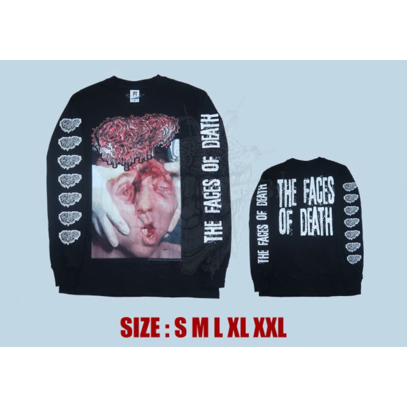 Ls Fetal deformity - the faces