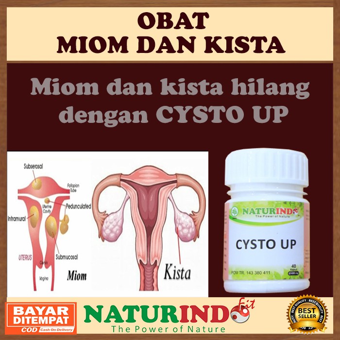 Obat Kista dan Miom Herbal Obat Kista Bartholin Kista Coklat Obat Kista Endometriosis Ampuh CYSTO UP
