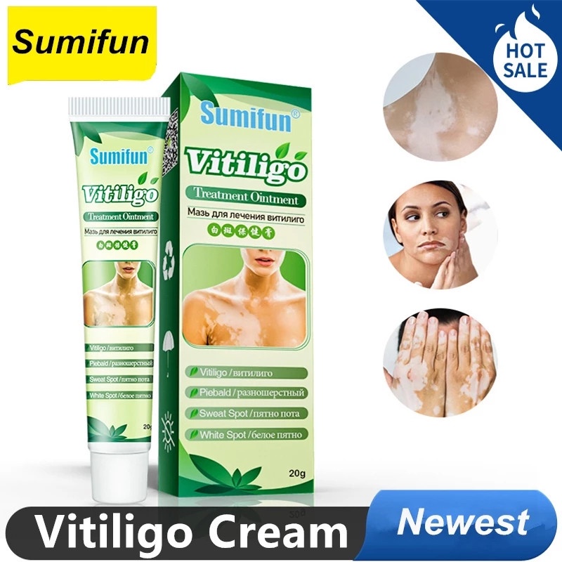 Sumifun Obat Salep Vitiligo Brecak Putih / Kulit Belang Pitih Krim Vitiligo Herbal - 20gr