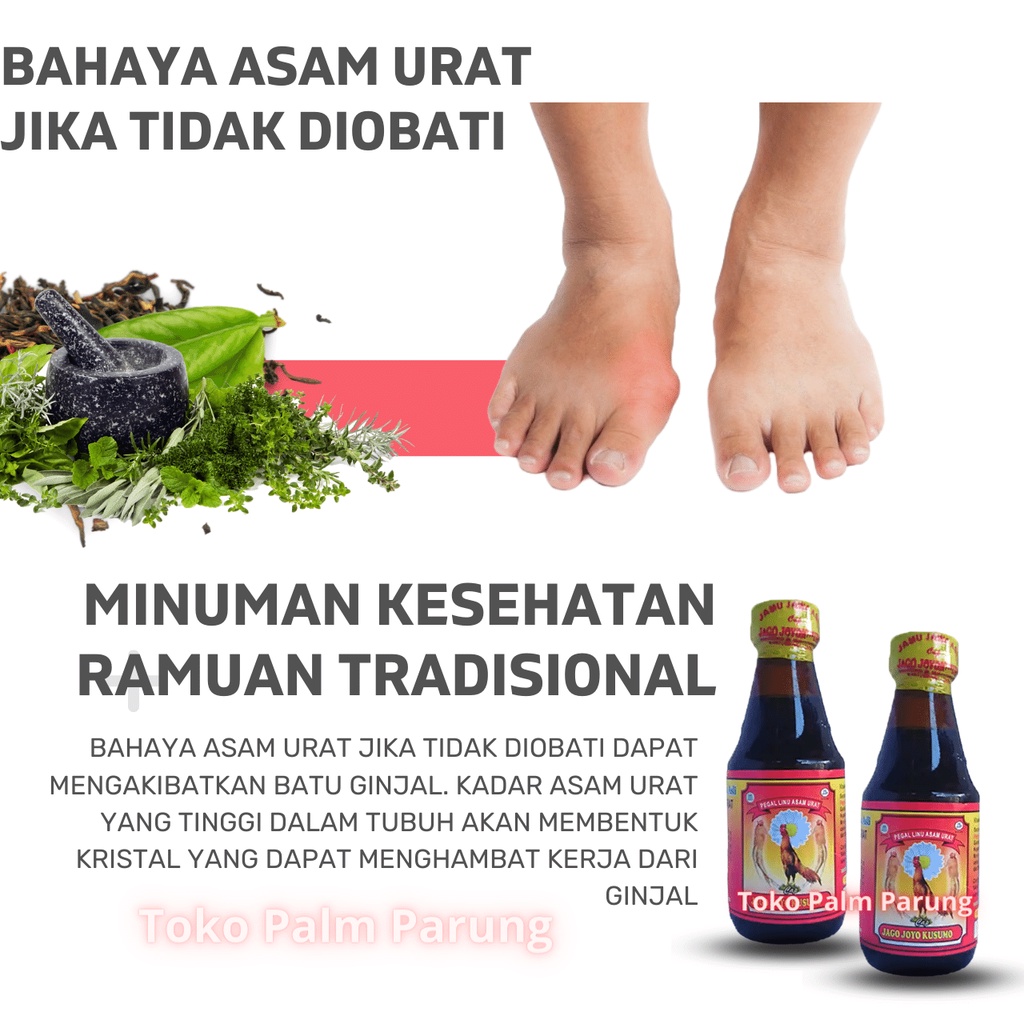 Jamu Jago Joyokusumo Usir Asam Urat Dan Pegal Linu Minuman Tradisional Mujarab Asli Herbal Alami