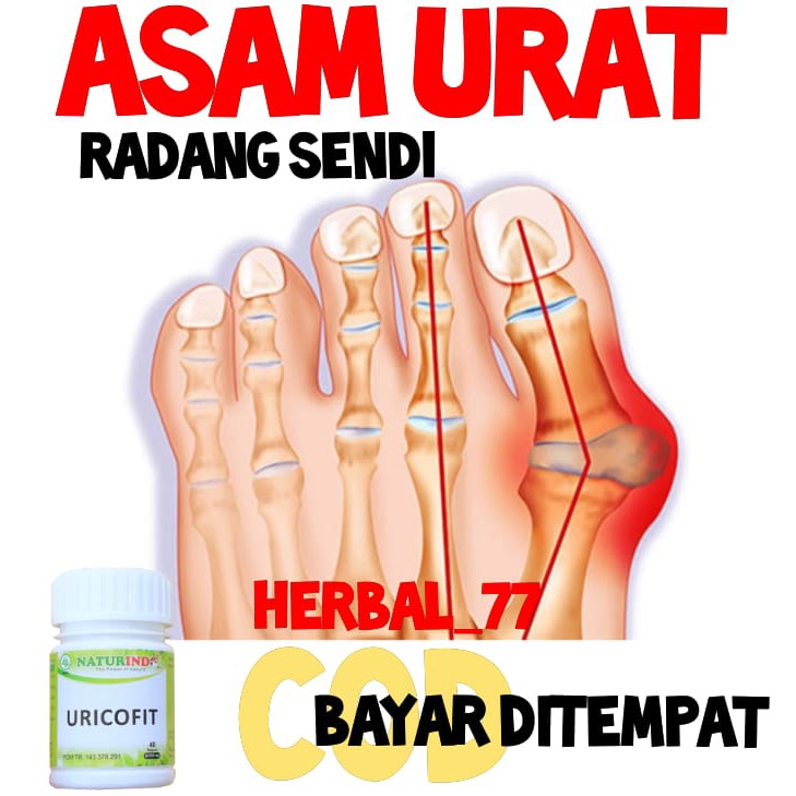 cod obat asam urat,t bengkak,obat herbal asam urat nyeri sendi