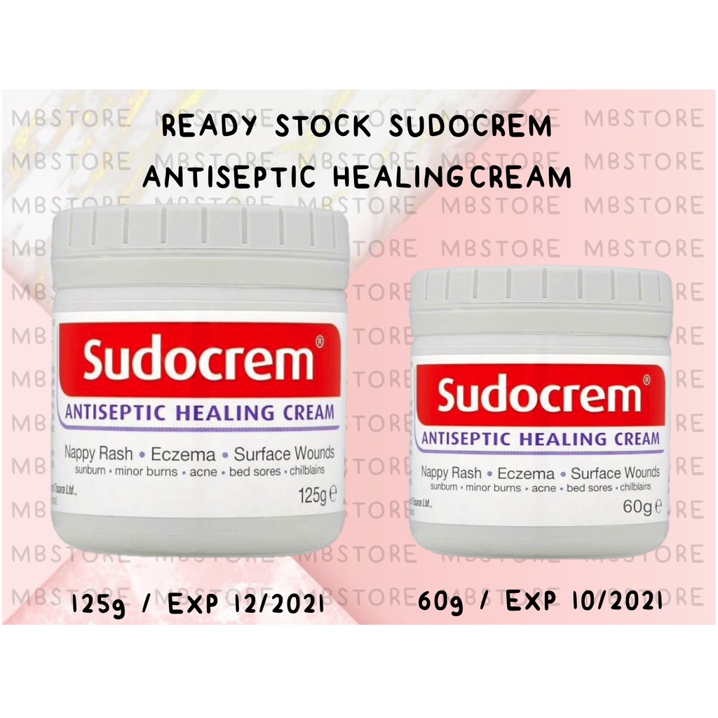 sudocrem sunburn baby