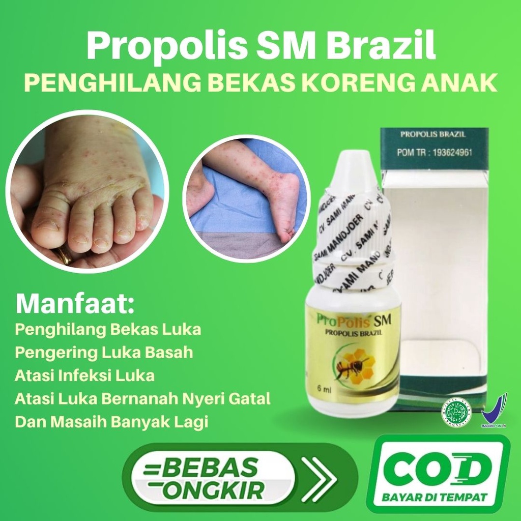 Penghilang Bekas Koreng Untuk Anak Anak Pengering Luka Pengobatan Luka Infeksi Luka Kronis Luka Bern