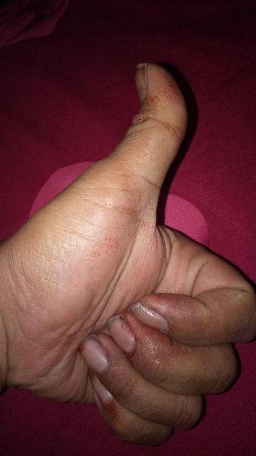 Xander Roda 1190 50mm Mati Trolley Trolli Troley 50 Mm 2 Inch