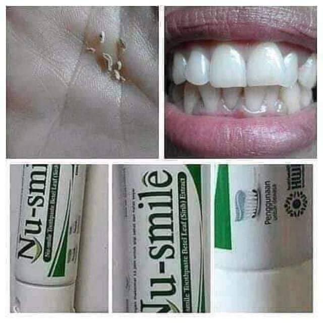 Nu smile