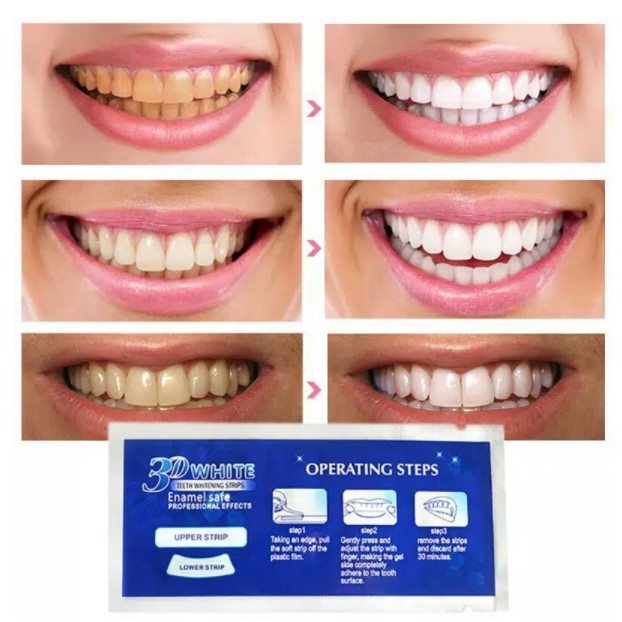 CREST 3D PEMUTIH 2 strip/pcs Strip Gel Pemutih Gigi 3D whitening teeth (1 atas 1 bawah) / 1 SACHET 2 Strip Pemutih Gigi 3d Warna Putih Unt Kebersihan Mulut/Hygiene Teeth 3D Whiten Tools Teeth Whitening