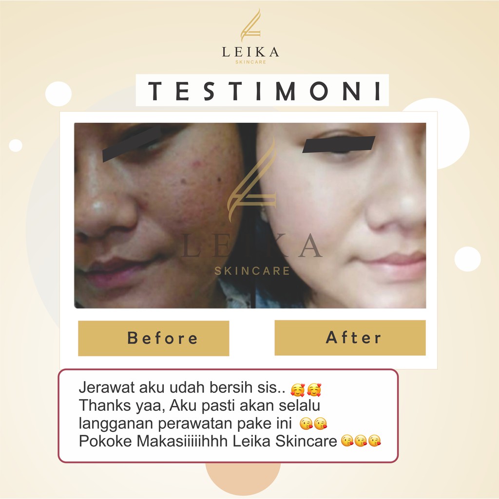 Leika Skincare Paket 5 in 1-3