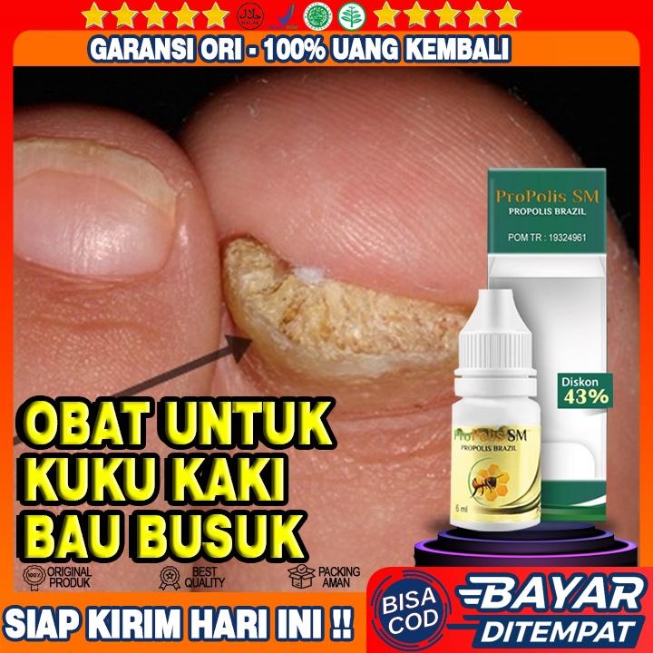 Obat Tetes Kuku Kaki Bau Busuk, Obat Nyeri Cantengan Kuku Kaki, Obat Tetes Bodoeusi, Propolis SM