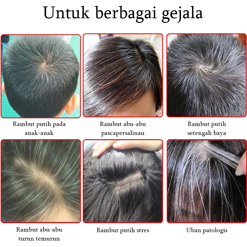 Hitam spray Hair growth serum spray Anti tonik rambut rontok Pertumbuhan rambut cepat 100ml Rambut putih tercepat di Indonesia menjadi rambut hitam Ekstrak tumbuhan alami Rambut hitam permanen