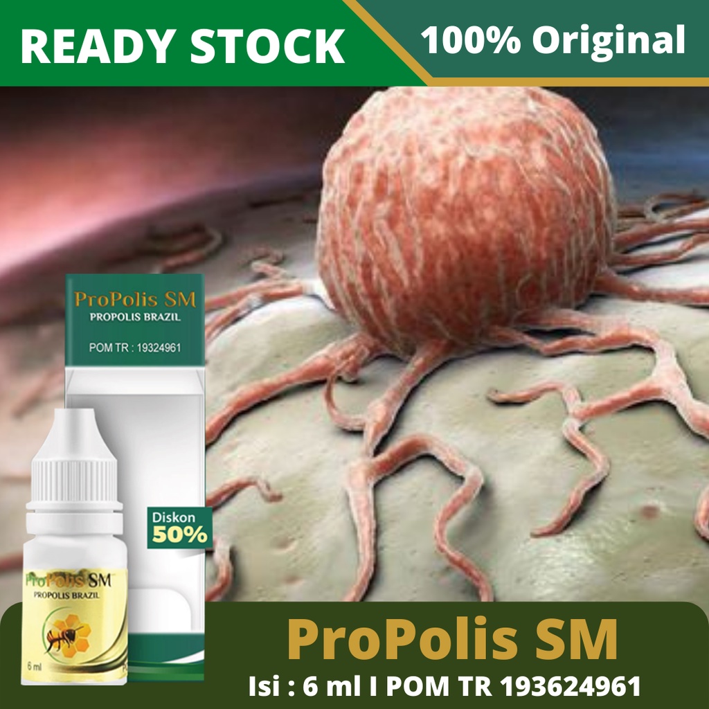 Obat Penyakit Tumor, Obat Tumor Jinak Dan Ganas, Obat Tumor Alami, Obat Tumor Tradisional, Tumor Otak, Tumor Payudara, Tumor Jantung,Tumor Rahim, Tumor Gusi, Tumor Kulit, Tumor Hati – ProPolis SM 100% Original BPOM