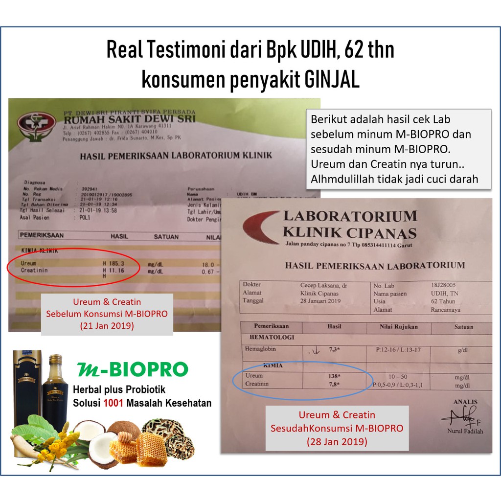 M Biopro Obat Untuk Ginjal | M Biopro Untuk Gagal Ginjal | M Biopro Untuk Batu Ginjal