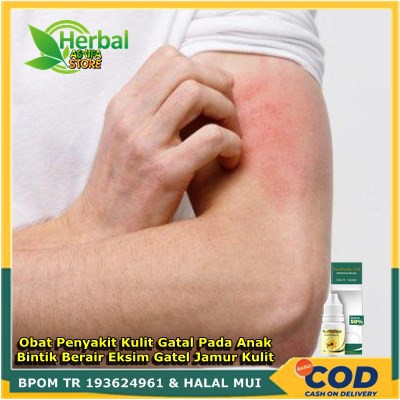 Propolis SM Obat Penyakit Kulit Gatal Pada Anak Bintik Berair Eksim Gatel Jamur Kulit Not Salep Cina