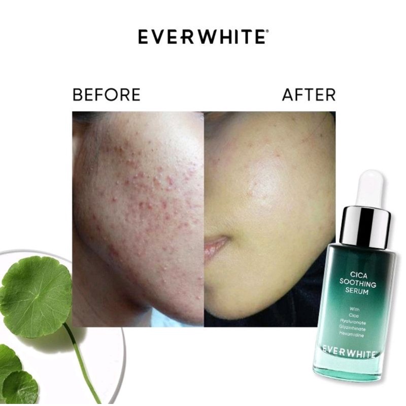 EVERWHITE Serum Series | Cica Soothing | Chromabright | Niacinamide | Aha Bha |Multi Action |Peptide