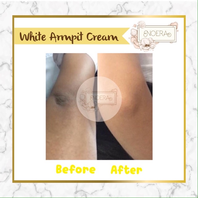 Noera Skin Lightening Cream | Armpit Cream Pemutih Lipatan Pemutih Ketiak Pemutih Selangkangan - BPOM