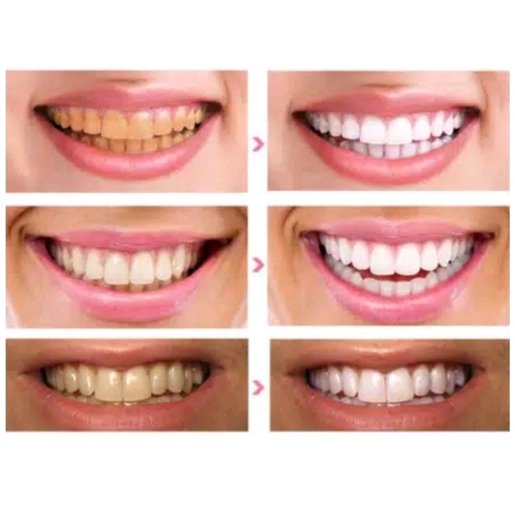 3d WHITE TEETH WHITENING STRIP / STRIP PEMUTIH GIGI ORAL B WHITE STRIP/PEMUTIH GIGI