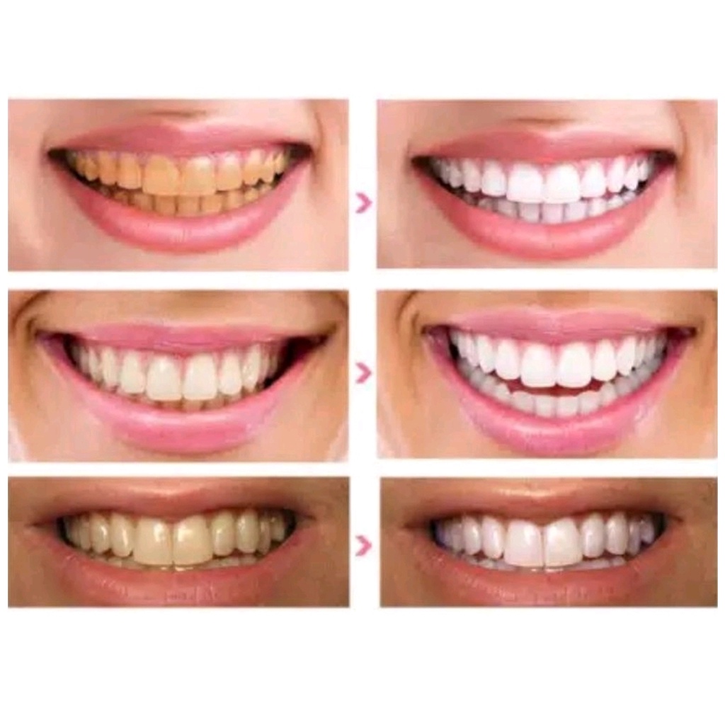 3d WHITE TEETH WHITENING STRIP / STRIP PEMUTIH GIGI ORAL B WHITE STRIP/STRIP PEMUTIH GIGI ORAL B WHITE STRIP