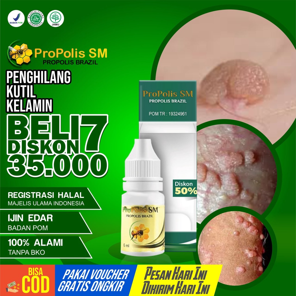 Penghilang Kutil Kelamin Benjol Di Kelamin Sariawan Vagina Bisul Di Kelamin - Pria Wanita Propolis SM