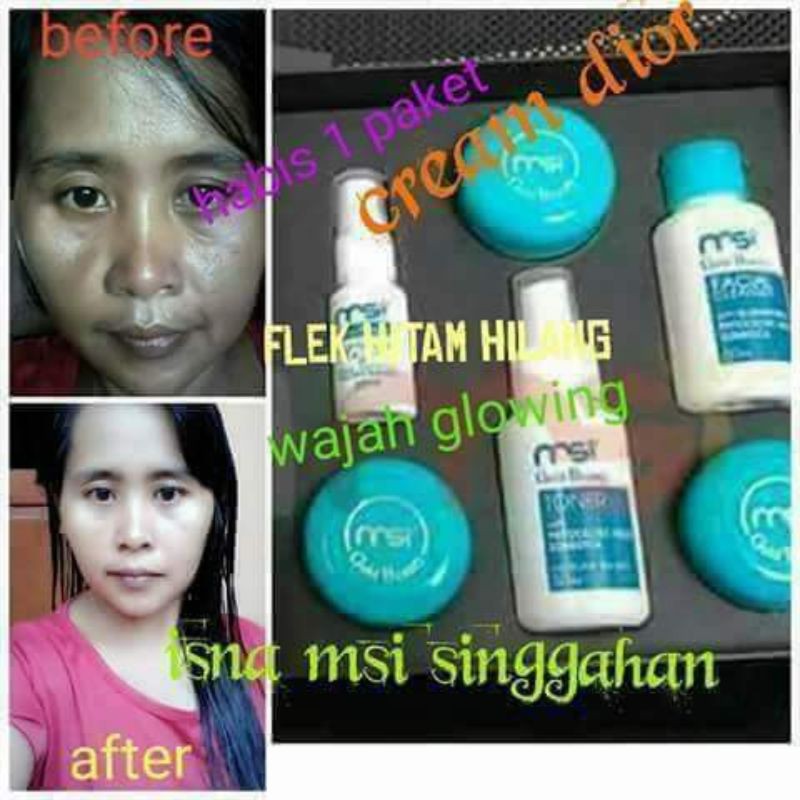 (MEMBER RESMI MSI) MSI GOLD BEAUTY