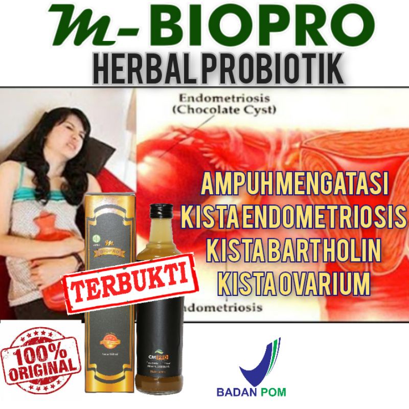 Obat Kista Ganglion l Obat Kista Ampuh Terbukti Mujarab