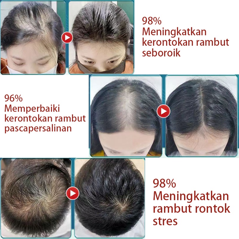 Shampoo Shampo Penumbuh Rambut Sampo 400ML Penumbuh Rambut Jahe Anti Rontok Rambut Sampo Anti Ketombe Dan Rontok