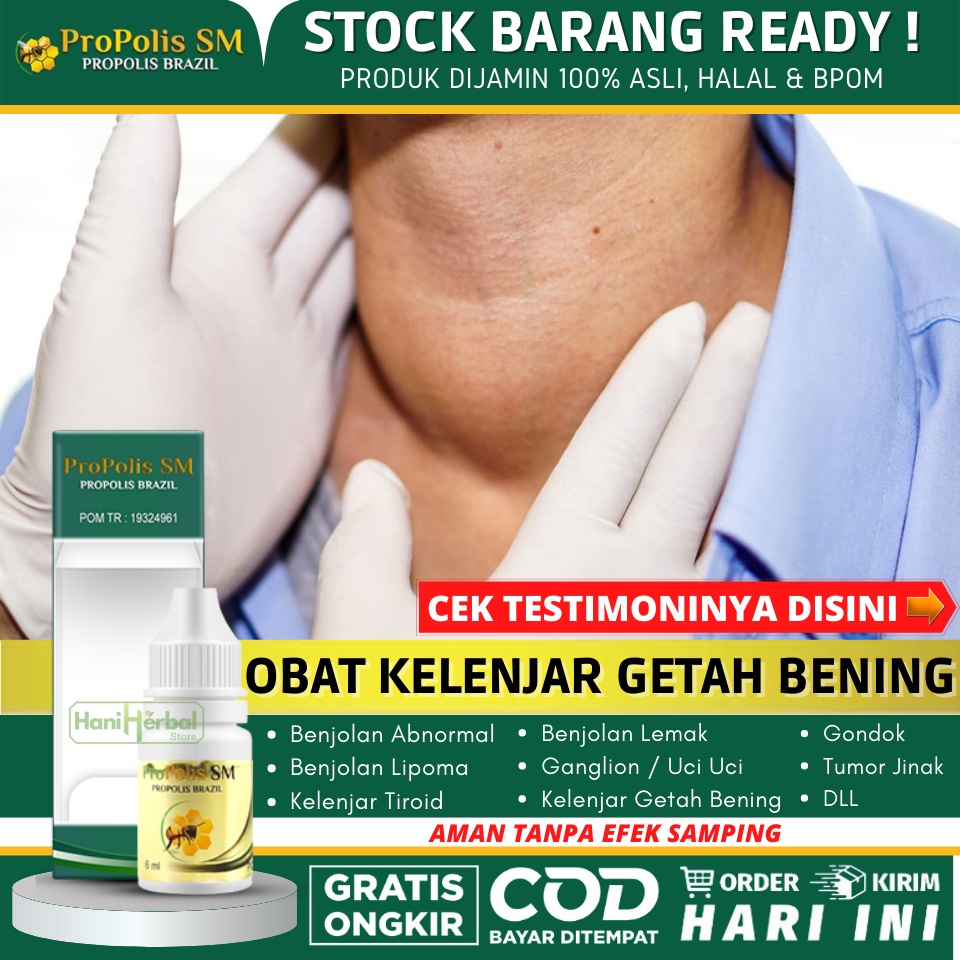OBAT KELENJAR GETAH BENING UNTUK ANAK & DEWASA 100% ALAMI - OBAT PENGHILANG / PENGEMPIS BENJOLAN KEL
