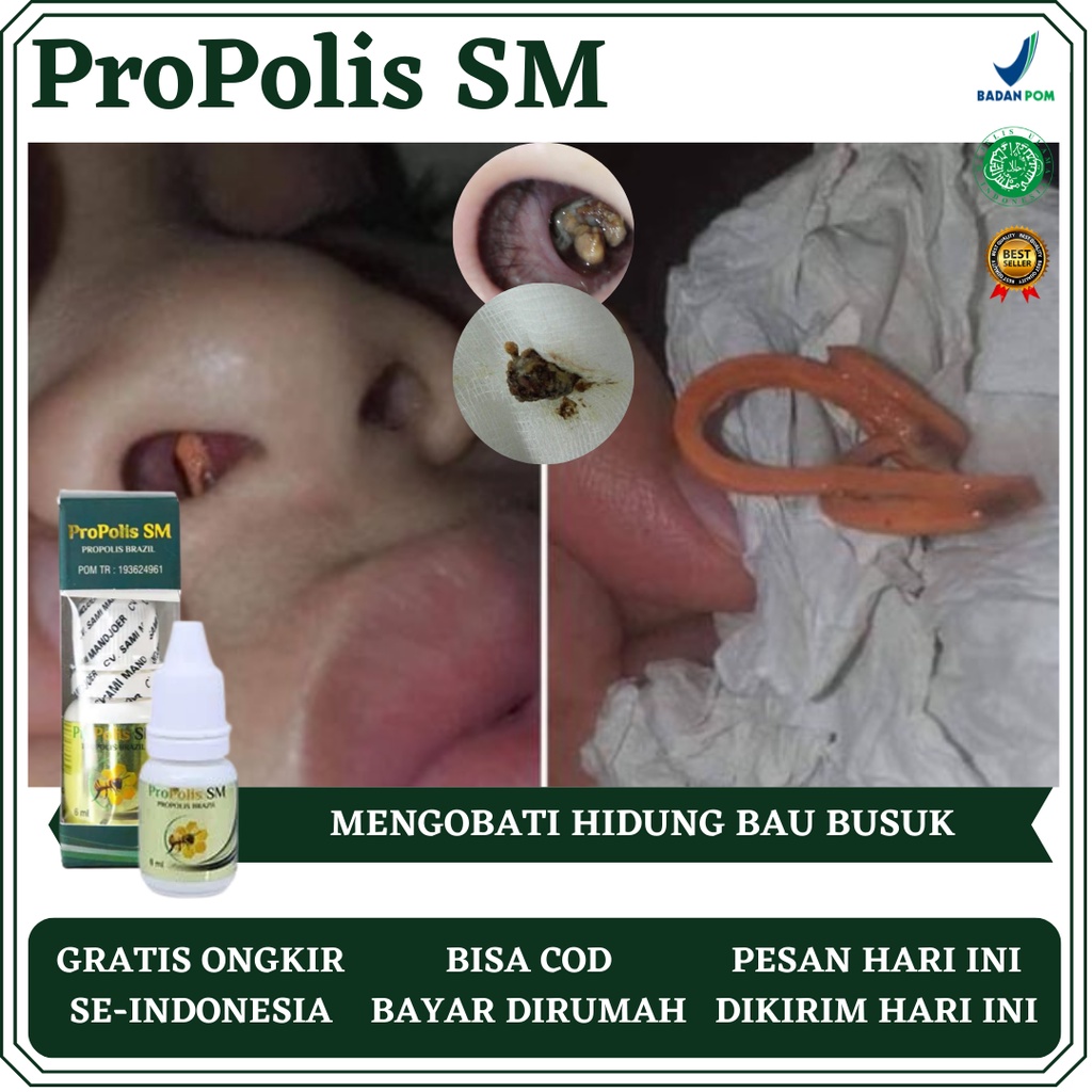 Obat Hidung Bau Busuk, Obat Hidung Bau Tak Sedap, Obat Hidung Berbau Menyengat, Obat Hidung Keluar C