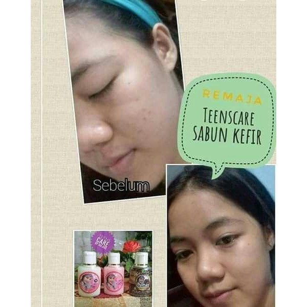 Day &amp; Night Cream Teens care Batrisyia